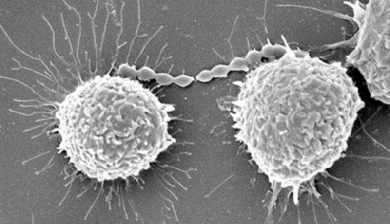 www.nusabali.com-songsong-usaba-dodol-warga-diimbau-waspada-meningitis-streptococcus-suis