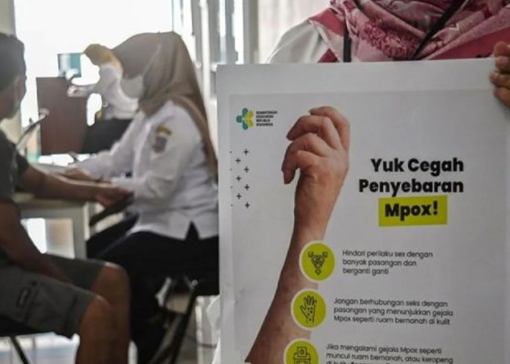 Nusabali.com - virus-mpox-merebak-belum-ada-larangan-turis-negara-tertentu-masuk-ri